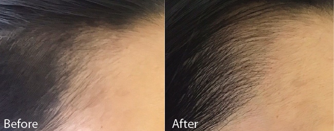 Natura Clinics | Hair Loss Solution Natura Clinics | Hair Loss Solution