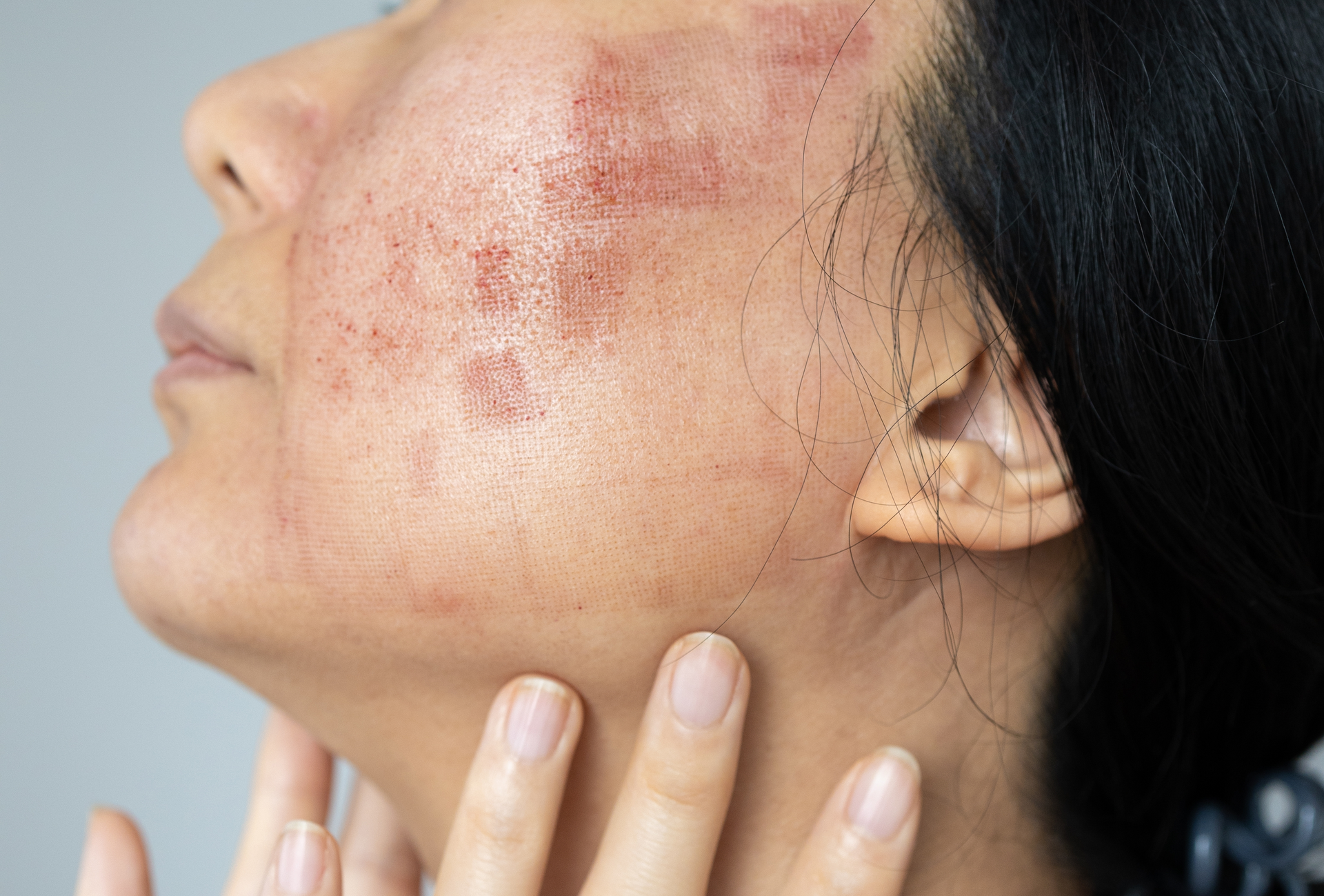 Natura Clinics | Facial & Cosmetics Natura Clinics | Facial & Cosmetics